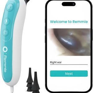 Remmie 4 AI-Powered Digital Otoscope with Light for Home Use - Ear Infection Checker for Kids & Adults - Nose Scope Video Camera with Telemedicine-Enabled App - FDA-Registered